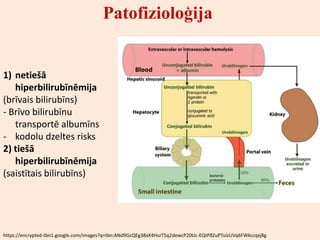 Patofizioloģija


1) netiešā
   hiperbilirubīnēmija
(brīvais bilirubīns)
- Brīvo bilirubīnu
   transportē albumīns
- kodolu dzeltes risks
2) tiešā
   hiperbilirubīnēmija
(saistītais bilirubīns)




https://encrypted-tbn1.google.com/images?q=tbn:ANd9GcQEg38xX4HszT5q2dewcP20tJc-EQtP8ZuPTulzUVq6FWkccqxj8g
 