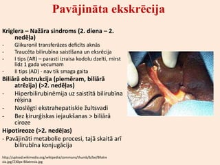 Pavājināta ekskrēcija
Kriglera – Nažāra sindroms (2. diena – 2.
     nedēļa)
-      Glikuronil transferāzes deficīts aknās
-      Traucēta bilirubīna saistīšana un eksrēcija
-      I tips (AR) – parasti izraisa kodolu dzelti, mirst
       līdz 1 gada vecumam
-      II tips (AD) - nav tik smaga gaita
Biliārā obstrukcija (piemēram, biliārā
     atrēzija) (>2. nedēļas)
-    Hiperbilirubinēmija uz saistītā bilirubīna
     rēķina
-    Noslēgti ekstrahepatiskie žultsvadi
-    Bez ķirurģiskas iejaukšanas > biliārā
     ciroze
Hipotireoze (>2. nedēļas)
- Pavājināti metabolie procesi, tajā skaitā arī
     bilirubīna konjugācija
http://upload.wikimedia.org/wikipedia/commons/thumb/b/be/Bilatre
sia.jpg/230px-Bilatresia.jpg
 