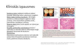 Klīniskās izpausmes 
.New England Journal of Medicine , Dan L. Longo, M.D., Editor,Serdar E. Bulun, M.D. 
Review article, Uterine fibrinoids. N Engl J Med 2013;369:1344-55 
Spiediena sajūta: palpējams veidojums vēdera 
lejasdaļā. Raksturīgs lieliem subseroziem mezgliem. 
Blakus orgānu funkciju traucējumi : dēļ mezgla 
spiediena uz blakusesošajiem orgāniem. Bieža 
urinācija, urīna nesaturēšana, grūtības urinēt, 
hidronefroze, aizcietējumi, tenesms. 
Muguras sāpes jostas, krustu apvidū, var izstarot par 
nerva gaitu. 
Neuglība, gŗūtniecības neiznēsāšana:iemesls ir 
submukozi un dzemdes dobumu deformējoši mezgli. 
Asinsainā: Samazināts Hb daudzums. 
Dismenoreja. 
Myomatous erythrocytosis sindroms, kurš rodas dēļ 
pastiprināta eritropoetīna produkcijas miomā vai 
nierēs, palielinot eritrocītu daudzumu. 
 