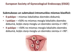 European Society of Gynecological Endoscopy (ESGE)
Submukozas un submukozi-intramurālas miomas klasificē:
• 0 pakāpe – miomas lokalizētas dzemdes dobumā;
• I pakāpe – >50% no miomas mezgla lokalizēts dzemdes
dobumā, leņķis starp mezglu un dzemdes sieniņu ir >90°;
• II pakāpe – <50% no miomas mezgla lokalizēts dzemdes
dobumā, leņķis starp mezglu un dzemdes sieniņu ir <90°.
I
0
II
II
 