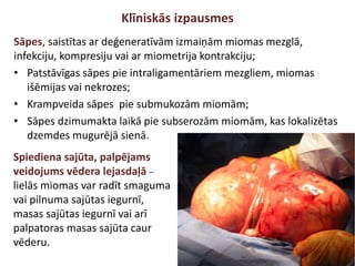 Klīniskās izpausmes
Sāpes, saistītas ar deģeneratīvām izmaiņām miomas mezglā,
infekciju, kompresiju vai ar miometrija kontrakciju;
• Patstāvīgas sāpes pie intraligamentāriem mezgliem, miomas
išēmijas vai nekrozes;
• Krampveida sāpes pie submukozām miomām;
• Sāpes dzimumakta laikā pie subserozām miomām, kas lokalizētas
dzemdes mugurējā sienā.
Spiediena sajūta, palpējams
veidojums vēdera lejasdaļā –
lielās miomas var radīt smaguma
vai pilnuma sajūtas iegurnī,
masas sajūtas iegurnī vai arī
palpatoras masas sajūta caur
vēderu.
 
