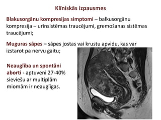 Klīniskās izpausmes
Blakusorgānu kompresijas simptomi – balkusorgānu
kompresija – urīnsistēmas traucējumi, gremošanas sistēmas
traucējumi;
Muguras sāpes – sāpes jostas vai krustu apvidu, kas var
izstarot pa nervu gaitu;
Neauglība un spontāni
aborti - aptuveni 27-40%
sieviešu ar multiplām
miomām ir neauglīgas.
 