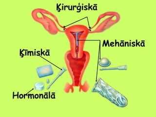 Ķirurģiskā

Ķīmiskā

Hormonālā

Mehāniskā

 