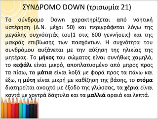 ΣΥΝΔΡΟΜΟ  DOWN  (τρισωμία 21) Το σύνδρομο  Down  χαρακτηρίζεται από νοητική υστέρηση (Δ.Ν. μέχρι 50) και περιγράφεται λόγω της μεγάλης συχνότητάς του(1 στις 600 γεννήσεις) και της μακράς επιβίωσης των πασχόντων. Η συχνότητα του συνδρόμου αυξάνεται με την αύξηση της ηλικίας της μητέρας. Το  μήκος  του σώματος είναι συνήθως χαμηλό, το  κεφάλι  είναι μικρό, αποπλατυσμένο από μπρος προς τα πίσω, τα  μάτια  είναι λοξά με φορά προς τα πάνω και έξω, η  μύτη  είναι μικρή με καθίζηση της βάσης, το  στόμα  διατηρείται ανοιχτό με έξοδο της γλώσσας, τα  χέρια  είναι κοντά με χοντρά δάχτυλα και τα  μαλλιά  αραιά και λεπτά.  