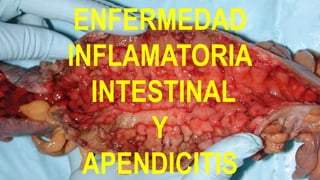 ENFERMEDAD
INFLAMATORIA
INTESTINAL
Y
APENDICITIS
 