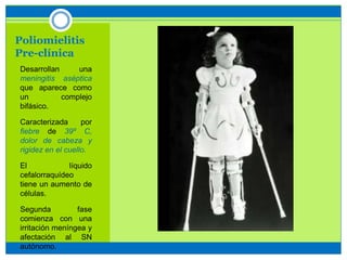 Poliomielitis
Pre-clínica
• Desarrollan una
meningitis aséptica
que aparece como
un complejo
bifásico.
• Caracterizada por
fiebre de 39º C,
dolor de cabeza y
rigidez en el cuello.
• El líquido
cefalorraquídeo
tiene un aumento de
células.
• Segunda fase
comienza con una
irritación meníngea y
afectación al SN
autónomo.
 