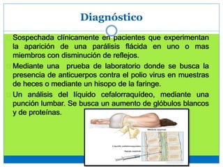 Diagnóstico
Sospechada clínicamente en pacientes que experimentan
la aparición de una parálisis flácida en uno o mas
miembros con disminución de reflejos.
Mediante una prueba de laboratorio donde se busca la
presencia de anticuerpos contra el polio virus en muestras
de heces o mediante un hisopo de la faringe.
Un análisis del líquido cefalorraquídeo, mediante una
punción lumbar. Se busca un aumento de glóbulos blancos
y de proteínas.
 