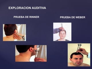 E.f.neurologico | PPTX