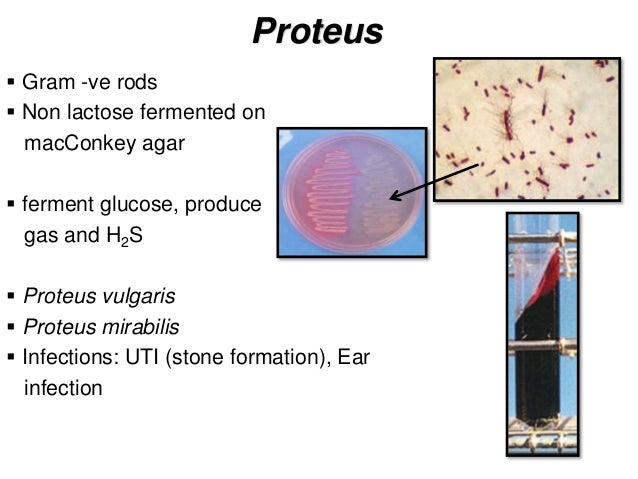 enterobacteracae