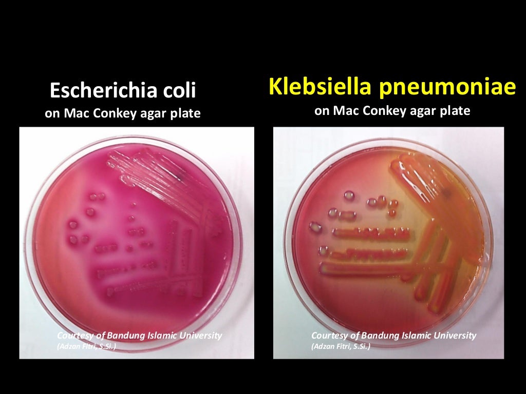 Escherichia coli что это у мужчин. Клебсиелла микробиология. Klebsiella pneumoniae культуральные свойства.