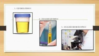 1.- EXAMEN FISICO
2.- ANALISIS QUIMICO
3.- ANALISIS MICROSCOPICO
 