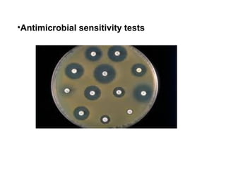 •Antimicrobial sensitivity tests
 