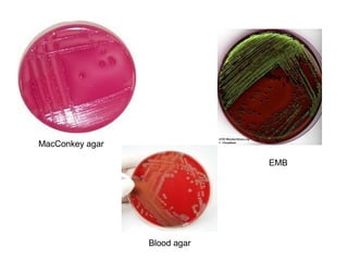 EMB
Blood agar
MacConkey agar
 