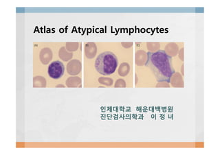 Atlas of Atypical Lymphocytes
인제대학교 해운대백병원
진단검사의학과 이 정 녀
 