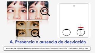 Romero-Apis, DA. Exploración Motora. En su: Estrabismo: Aspectos Clínicos y Tratamiento. Editorial DALA. Ciudad de México, 2010, pp. 71-101.
A. Presencia o ausencia de desviación
 