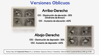 Versiones Oblicuas
Romero-Apis, DA. Exploración Motora. En su: Estrabismo: Aspectos Clínicos y Tratamiento. Editorial DALA. Ciudad de México, 2010, pp. 71-101.
Arriba-Derecha
OII - Disminución de elevación -30%
(Síndrome de Brown)
OII - Aumento de elevación +60%
Abajo-Derecha
OSI - Disminución de depresión -30%
OSI- Aumento de depresión +60%
 