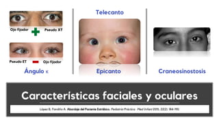 Características faciales y oculares
Telecanto
EpicantoÁngulo κ
Ojo fijador Pseudo XT
Ojo fijadorPseudo ET
Craneosinostosis
López B, Fandiño A. Abordaje del Paciente Estrábico. Pediatría Práctica. Med Infant 2015; 22(2): 184-190.
 