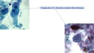Trophozoite of E. histolytica stained with trichrome.
 