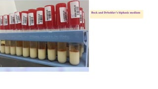 Bock and Drbohlav's biphasic medium
 