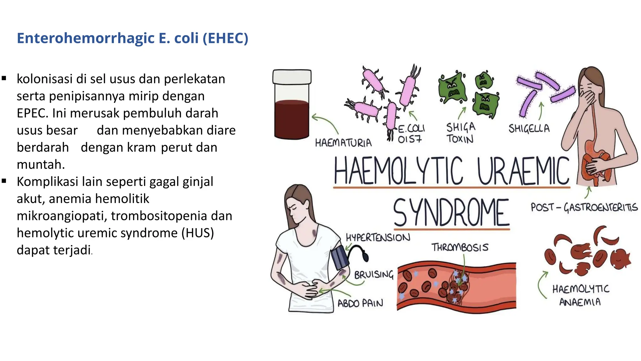 bakteri e. coli escherichia coli dengan Gastroesophageal reflux disease ...