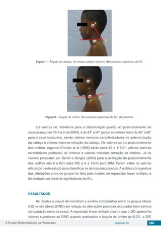 A Função Multiprofissional da Fisioterapia Capítulo 23 180
Figura 1 – Ângulo de cabeça: (A) meato auditivo externo; (B) processo espinhoso de C7.
Figura 2 – Ângulo do ombro: (B) processo espinhoso de C7; (C) acrômio.
Os valores de referência para a classificação quanto ao posicionamento da
cabeça segundo Penha et al (2009), é de 43° a 56° para o sexo feminino e de 45° a 60°
para o sexo masculino, sendo valores menores caracterizadores de anteriorização
da cabeça e valores maiores retração da cabeça. Os valores para o posicionamento
dos ombros segundo Christie et al (1995) estão entre 89 e 119,2°, valores maiores
caracterizam protrusão de ombros e valores menores retração de ombros. Já os
valores propostos por Bertol e Borges (2004) para a avaliação do posicionamento
dos joelhos são 6 a 8cm para DIC e 8 a 15cm para DIM. Foram estes os valores
utilizados neste estudo para classificar os alunos pesquisados. A análise comparativa
das alterações entre os grupos foi feita pelo modelo de regressão linear múltiplo, e
foi adotado um nível de significância de 5%.
RESULTADOS
As tabelas a seguir demonstram a análise comparativa entre os grupos obeso
(GO) e não obeso (GNO) em relação às alterações posturais estudadas bem como a
comparação entre os sexos. A regressão linear múltipla mostra que o GO apresenta
valores superiores ao GNO quando analisados o ângulo de ombro (p=0,02), a DIC
 