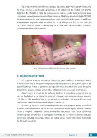 A Função Multiprofissional da Fisioterapia Capítulo 6 53
No antepenúltimo atendimento, realizou-se a troca da pomada para Sulfadiazina
de prata, no qual, é destinado à prevenção e ao tratamento de feridas com grande
potencial de infecção e risco de evolução para sepse, tendo maior potencial para
retirada do esfacelo presente na ferida do paciente. No último atendimento 20/06/2018
foi possível observar uma pequena melhora tanto na cicatrização como no tecido em
si, obtendo as seguintes medidas: altura de 1,4 cm e largura de 0,4 cm, com redução
de 0,3 cm tanto na altura como na largura, e uma melhora no esfacelo presente,
podendo ser observado na foto 2.
Foto 2 – Atendimento dia 20/06/2018, foto do próprio autor.
3 | 	CONSIDERAÇÕES FINAIS
Foi possível observar resultados satisfatório, pois sua ferida era antiga, crônica
a mais de um ano, e em pouco tempo conseguimos reduzi-la em 0,3 cm, apesar de
podermos ter de reduzi-la bem mais se o paciente não fosse fumante, pois a nicotina
presente no cigarro impede uma melhor eficácia em processos de cicatrização.
Assim, como a presença de esfacelo também é prejudicial, após o início do
uso da Sulfadiazina de prata foi possível observar uma redução desse esfacelo
nos últimos três atendimentos, se o mesmo tivesse iniciado o tratamento com essa
medicação, talvez obtivéssemos melhores resultados.
Portanto, a dermato funcional está no mercado também para a área traumática
e lesões, não sendo única e exclusiva do mercado de estética para embelezamento
facial e corpora. Trazendo então excelentes resultados com seus aparelhos
eletroterapicos para feridas e ulcerações. Contudo, se faz necessário mais estudos
científicos, estudos de campo, relatos de casos para a maior visibilidade deste lado
da dermato funcional.
 