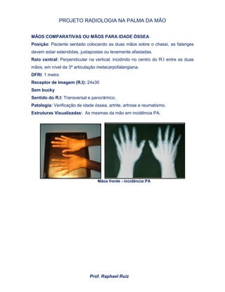 PROJETO RADIOLOGIA NA PALMA DA MÃO
Prof. Raphael Ruiz
MÃOS COMPARATIVAS OU MÃOS PARA IDADE ÓSSEA
Posição: Paciente sentado colocando as duas mãos sobre o chassi, as falanges
devem estar estendidas, justapostas ou levemente afastadas.
Raio central: Perpendicular na vertical, incidindo no centro do R.I entre as duas
mãos, em nível da 3º articulação metacarpofalangiana.
DFRI: 1 metro
Receptor de Imagem (R.I): 24x30
Sem bucky
Sentido do R.I: Transversal e panorâmico.
Patologia: Verificação de idade óssea, artrite, artrose e reumatismo.
Estruturas Visualizadas: As mesmas da mão em incidência PA.
Mãos frente - incidência PA
 