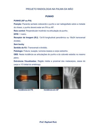 PROJETO RADIOLOGIA NA PALMA DA MÃO
Prof. Raphael Ruiz
PUNHO
PUNHO (AP ou PA)
Posição: Paciente sentado colocando o punho a ser radiografado sobre a metade
do chassi, o punho deverá estar em PA ou AP.
Raio central: Perpendicular incidindo na articulação do punho.
DFRI: 1 metro.
Receptor de Imagem (R.I): 13x18 longitudinal panorâmico ou 18x24 transversal
dividido.
Sem bucky
Sentido do R.I: Transversal e dividido.
Patologia: Fratura, luxação, tumores ósseos e corpo estranho.
OBS: Nesta incidência as articulações do punho e do cotovelo estarão no mesmo
plano.
Estruturas Visualizadas: Região média e proximal dos metacarpos, ossos do
carpo e 1/3 distal do antebraço.
Incidência em PA Incidência em AP
 