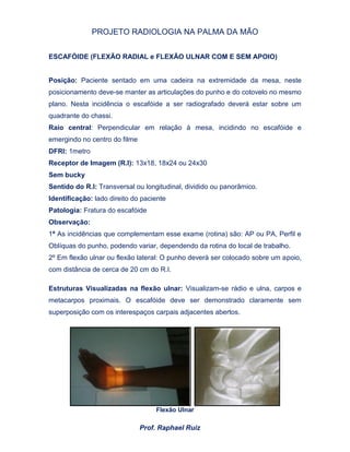PROJETO RADIOLOGIA NA PALMA DA MÃO
Prof. Raphael Ruiz
ESCAFÓIDE (FLEXÃO RADIAL e FLEXÃO ULNAR COM E SEM APOIO)
Posição: Paciente sentado em uma cadeira na extremidade da mesa, neste
posicionamento deve-se manter as articulações do punho e do cotovelo no mesmo
plano. Nesta incidência o escafóide a ser radiografado deverá estar sobre um
quadrante do chassi.
Raio central: Perpendicular em relação à mesa, incidindo no escafóide e
emergindo no centro do filme
DFRI: 1metro
Receptor de Imagem (R.I): 13x18, 18x24 ou 24x30
Sem bucky
Sentido do R.I: Transversal ou longitudinal, dividido ou panorâmico.
Identificação: lado direito do paciente
Patologia: Fratura do escafóide
Observação:
1º As incidências que complementam esse exame (rotina) são: AP ou PA, Perfil e
Oblíquas do punho, podendo variar, dependendo da rotina do local de trabalho.
2º Em flexão ulnar ou flexão lateral: O punho deverá ser colocado sobre um apoio,
com distância de cerca de 20 cm do R.I.
Estruturas Visualizadas na flexão ulnar: Visualizam-se rádio e ulna, carpos e
metacarpos proximais. O escafóide deve ser demonstrado claramente sem
superposição com os interespaços carpais adjacentes abertos.
Flexão Ulnar
 