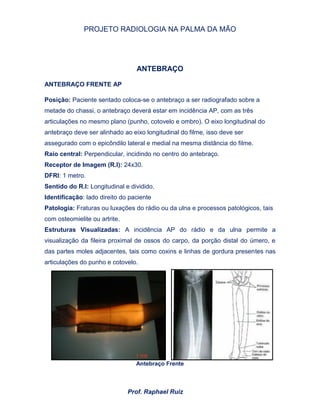 PROJETO RADIOLOGIA NA PALMA DA MÃO
Prof. Raphael Ruiz
ANTEBRAÇO
ANTEBRAÇO FRENTE AP
Posição: Paciente sentado coloca-se o antebraço a ser radiografado sobre a
metade do chassi, o antebraço deverá estar em incidência AP, com as três
articulações no mesmo plano (punho, cotovelo e ombro). O eixo longitudinal do
antebraço deve ser alinhado ao eixo longitudinal do filme, isso deve ser
assegurado com o epicôndilo lateral e medial na mesma distância do filme.
Raio central: Perpendicular, incidindo no centro do antebraço.
Receptor de Imagem (R.I): 24x30.
DFRI: 1 metro.
Sentido do R.I: Longitudinal e dividido.
Identificação: lado direito do paciente
Patologia: Fraturas ou luxações do rádio ou da ulna e processos patológicos, tais
com osteomielite ou artrite.
Estruturas Visualizadas: A incidência AP do rádio e da ulna permite a
visualização da fileira proximal de ossos do carpo, da porção distal do úmero, e
das partes moles adjacentes, tais como coxins e linhas de gordura presentes nas
articulações do punho e cotovelo.
Antebraço Frente
 