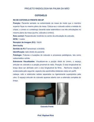 PROJETO RADIOLOGIA NA PALMA DA MÃO
Prof. Raphael Ruiz
COTOVELO
RX DE COTOVELO FRENTE EM AP
Posição: Paciente sentado na extremidade da mesa de modo que o membro
superior fique no mesmo plano da mesa. Coloca-se o cotovelo sobre a metade do
chassi, o úmero e o antebraço deverão estar estendidos e as três articulações no
mesmo plano da mesa (punho, cotovelo e ombro).
Raio central: Perpendicular incidindo no centro da articulação do cotovelo.
DFRI: 1 metro
Receptor de Imagem (R.I): 18x24
Sem bucky
Sentido do R.I:Transversal, e dividido.
Identificação: lado direito do paciente
Patologia: Fraturas e luxações do cotovelo e processos patológicos, tais como
osteomielite e artrite.
Estruturas Visualizadas: Visualizam-se a porção distal do úmero, o espaço
articular do cotovelo e a porção proximal do rádio. Posição: O eixo longitudinal do
braço deve ser alinhado com o eixo longitudinal do filme. . Nenhuma rotação é
evidenciada pelo seguinte: aspecto dos epicôndilos bilaterais vistos em perfil;
cabeça, colo e tubérculos radiais separados ou ligeiramente superpostos pela
ulna. O espaço articular do cotovelo aparece aberto com a extensão completa do
braço.
Cotovelo Frente
 