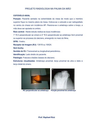 PROJETO RADIOLOGIA NA PALMA DA MÃO
Prof. Raphael Ruiz
COTOVELO AXIAL
Posição: Paciente sentado na extremidade da mesa de modo que o membro
superior fique no mesmo plano da mesa. Coloca-se o cotovelo a ser radiografado
no centro do chassi em incidência AP. Flexiona-se o antebraço sobre o braço, a
mão deve ser apoiada no ombro.
Raio central : Neste estudo realiza-se duas incidências:
1° R.C perpendicular ao úmero e 2° R.C perpendicular ao antebraço 5cm proximal
ou superior ao processo do olecrano, emergindo no meio do filme.
DFRI: 1metro.
Receptor de Imagem (R.I): 13X18 ou 18X24.
Sem bucky.
Sentido do R.I: Transversal ou longitudinal panorâmico.
Identificação: Lado direito do paciente.
Patologia: Fraturas e lesões ósseas do olecrano.
Estruturas visualizadas: Antebraço proximal, terço proximal da ulna e rádio e
terço distal do úmero.
RC perpendicular ao antebraço Porção proximal do antebraço
 