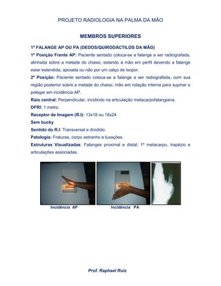 PROJETO RADIOLOGIA NA PALMA DA MÃO
Prof. Raphael Ruiz
MEMBROS SUPERIORES
1º FALANGE AP OU PA (DEDOS/QUIRODÁCTILOS DA MÃO)
1º Posição Frente AP: Paciente sentado coloca-se a falange a ser radiografada,
alinhada sobre a metade do chassi, estando à mão em perfil devendo a falange
estar estendida, apoiada ou não por um calço de isopor.
2º Posição: Paciente sentado coloca-se a falange a ser radiografada, com sua
região posterior sobre a metade do chassi, mão em rotação interna para supinar o
polegar em incidência AP.
Raio central: Perpendicular, incidindo na articulação metacarpofalangiana.
DFRI: 1 metro.
Receptor de Imagem (R.I): 13x18 ou 18x24
Sem bucky
Sentido do R.I: Transversal e dividido.
Patologia: Fraturas, corpo estranho e luxações.
Estruturas Visualizadas: Falanges proximal e distal, 1º metacarpo, trapézio e
articulações associadas.
Incidência AP Incidência PA
 