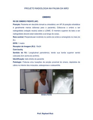 PROJETO RADIOLOGIA NA PALMA DA MÃO
Prof. Raphael Ruiz
OMBRO
RX DE OMBRO FRENTE (AP)
Posição: Paciente em decúbito dorsal ou ortostático, em AP (A posição ortostática
é geralmente menos dolorosa para o paciente). Coloca-se o ombro a ser
radiografado (rotação neutra) sobre a LCM/E. O membro superior do lado a ser
radiografado deverá estar estendido a ao longo do corpo.
Raio central: Perpendicular incidindo no centro do ombro e emergindo no meio do
R.I.
DFRI: 1 metro
Receptor de Imagem (R.I): 18x24
Com bucky
Sentido do R.I: Longitudinal panorâmico, tendo sua borda superior sendo
colocada 2cm acima do acrômio.
Identificação: lado direito do paciente
Patologia: Fraturas e/ou luxações da porção proximal do úmero, depósitos de
cálcio no interior dos músculos, osteoporose e osteoartrite.
Ombro frente
 