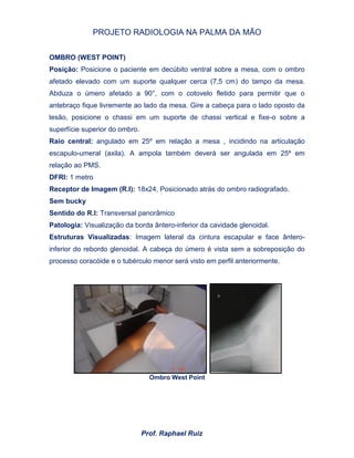 PROJETO RADIOLOGIA NA PALMA DA MÃO
Prof. Raphael Ruiz
OMBRO (WEST POINT)
Posição: Posicione o paciente em decúbito ventral sobre a mesa, com o ombro
afetado elevado com um suporte qualquer cerca (7,5 cm) do tampo da mesa.
Abduza o úmero afetado a 90°, com o cotovelo fletido para permitir que o
antebraço fique livremente ao lado da mesa. Gire a cabeça para o lado oposto da
lesão, posicione o chassi em um suporte de chassi vertical e fixe-o sobre a
superfície superior do ombro.
Raio central: angulado em 25º em relação a mesa , incidindo na articulação
escapulo-umeral (axila). A ampola também deverá ser angulada em 25º em
relação ao PMS.
DFRI: 1 metro
Receptor de Imagem (R.I): 18x24, Posicionado atrás do ombro radiografado.
Sem bucky
Sentido do R.I: Transversal panorâmico
Patologia: Visualização da borda ântero-inferior da cavidade glenoidal.
Estruturas Visualizadas: Imagem lateral da cintura escapular e face ântero-
inferior do rebordo glenoidal. A cabeça do úmero é vista sem a sobreposição do
processo coracóide e o tubérculo menor será visto em perfil anteriormente.
Ombro West Point
 