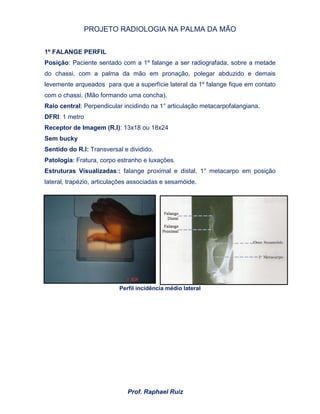 PROJETO RADIOLOGIA NA PALMA DA MÃO
Prof. Raphael Ruiz
1º FALANGE PERFIL
Posição: Paciente sentado com a 1º falange a ser radiografada, sobre a metade
do chassi, com a palma da mão em pronação, polegar abduzido e demais
levemente arqueados para que a superfície lateral da 1º falange fique em contato
com o chassi. (Mão formando uma concha).
Raio central: Perpendicular incidindo na 1° articulação metacarpofalangiana.
DFRI: 1 metro
Receptor de Imagem (R.I): 13x18 ou 18x24
Sem bucky
Sentido do R.I: Transversal e dividido.
Patologia: Fratura, corpo estranho e luxações.
Estruturas Visualizadas:: falange proximal e distal, 1° metacarpo em posição
lateral, trapézio, articulações associadas e sesamóide.
Perfil incidência médio lateral
 