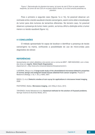 Medicina e Biomedicina Capítulo 8 65
Figura 1: Reconstrução do phantom da mama, (a) tumor de raio 0,75cm na parte superior
esquerda, (b) tumor de raio 0,35 cm na parte inferior direita, (c) os dois tumores presentes no
phantom.
Para o primeiro e segundo caso (figuras 1a e 1b), foi possível observar um
contraste entre o tecido saudável e tecido cancerígeno, assim como obter a localização
do tumor para dois tumores de tamanhos diferentes. No terceiro caso, foi possível
observar a presença do tumor maior, porém, se tornou difícil a distinção entre o tumor
menor e o tecido saudável (figura 1c).
4 | 	CONCLUSÕES
O método apresentado foi capaz de localizar e identificar a presença de tecido
cancerígeno na mama, verificando a possibilidade do uso de micro-ondas para
diagnóstico de câncer.
REFERÊNCIAS
Apresentadas em ordem alfabética e de acordo com a norma da ABNT - NBR 6023/2002, com o título
das obras em negrito. Wolrd Heath Organization,
disponível em: <http://www.who.int/cancer/detection/breastcancer/en/>
LAZEBNIK, Mariya et al. A large-scale study of the ultrawideband microwave dielectric properties
of normal, benign and malignant breast tissues obtained from cancer surgeries. Physics in
Medicine & Biology, v. 52, n. 20, p. 6093, 2007.
BINDU, G. et al. Dielectric studies of corn syrup for applications in microwave breast imaging.
2006.
PASTORINO, Matteo. Microwave imaging. John Wiley & Sons, 2010.
TIKHONOV, Andreĭ Nikolaevich et al. Numerical methods for the solution of ill-posed problems.
Springer Science & Business Media, 2013.
 