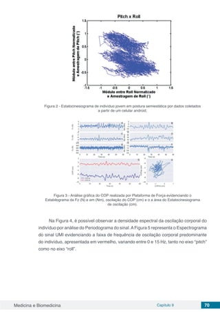 Medicina e Biomedicina Capítulo 9 70
Figura 2 - Estatocinesiograma de indivíduo jovem em postura semiestática por dados coletados
a partir de um celular android.
Figura 3 - Análise gráfica do COP realizada por Plataforma de Força evidenciando o
Estabilograma da Fz (N) e em (Nm), oscilação do COP (cm) e o a área do Estatocinesiograma
de oscilação (cm).
Na Figura 4, é possível observar a densidade espectral da oscilação corporal do
indivíduo por análise do Periodograma do sinal.AFigura 5 representa o Espectrograma
do sinal UMI evidenciando a faixa de frequência de oscilação corporal predominante
do indivíduo, apresentada em vermelho, variando entre 0 e 15 Hz, tanto no eixo “pitch”
como no eixo “roll”.
 
