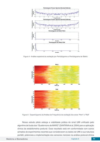 Medicina e Biomedicina Capítulo 9 71
Figura 4 - Análise espectral da oscilação por Periodograma e Periodograma de Welch.
Figura 5 - Espectrograma da Análise de Frequência da oscilação dos eixos ‘Pitch” e “Roll”
Nosso estudo piloto esboça a viabilidade prática do sinal UMI unificado pelo
algoritmo de fusão dos “Quatérnions de MARG” (SANTANAet al, 2004) para a aplicação
clínica da estabilometria postural. Esse resultado está em conformidade com outros
achados de experimentos recentes que consideraram os dados de UMI e sua natureza
portátil, potenciais a implementação dos sensores inerciais na análise postural clínica
 