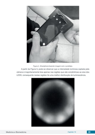 Medicina e Biomedicina Capítulo 10 80
Figura 4. Smartphone fazendo imagem com o protótipo.
A partir da Figura 5, pode-se observar que a intensidade luminosa captada pela
câmera é majoritariamente boa apenas nas regiões que são concêntricas ao eixo dos
LEDS, consequente nestas regiões há uma melhor distribuição de luminescência.
 