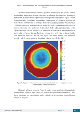 Medicina e Biomedicina Capítulo 10 81
Figura 5. Imagem capturada pelo smartphone em escala de cinza. Interpolação bicúbica foi
utilizada.
Da análise de distribuição luminosa, pode-se observar que que há uma falta de
sensibilidade por parte da câmera. Logo, para a realização da imagem em falsas cores
da Figura 6, que se trata do espectro de distribuição de densidade da Figura 5 foram
desconsideradas densidades intensidades maiores que 0.3. Pode-se observar de
melhor forma o limite radial da formação do efeito difuso pelo protótipo. Visualmente, é
possível notar que há uma faixa na qual o efeito pode ser observado, estando contida,
aproximadamente, entre o intervalo de densidade de 0.1 a 0.3, considerando o centro
da geometria circular da imagem, e a geometria do protótipo é possível estimar a
penetração em função do raio. Existe um raio de 5mm onde nota-se baixa difusão,
com densidade entre 0.03 a 0.09. Uma região com média difusão, com densidade
entre 0.1 a 0.15 e uma região de densidade máxima entre 0.15 a 0.3.
Figura 6. Espectro de intensidade luminosa da imagem formada com o protótipo em contato
com antebraço, valores normalizados.
A Figura 7 refere-se a mesma Figura 5, porém nesse caso foram filtradas todas
as densidades acima de 0.15, e optou-se pela visualização em escala de cinza. Desta
forma é possível ver claramente o efeito e influência da geometria do protótipo na
análise da imagem.
 