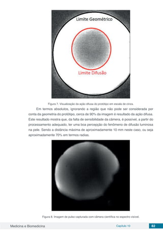 Medicina e Biomedicina Capítulo 10 82
Figura 7. Visualização da ação difusa do protótipo em escala de cinza.
Em termos absolutos, ignorando a região que não pode ser considerada por
conta da geometria do protótipo, cerca de 90% da imagem é resultado da ação difusa.
Este resultado mostra que, da falta de sensibilidade da câmera, é possível, a partir do
processamento adequado, ter uma boa percepção do fenômeno de difusão luminosa
na pele. Sendo a distância máxima de aproximadamente 10 mm neste caso, ou seja
aproximadamente 70% em termos radias.
Figura 8. Imagem de pulso capturada com câmera científica no espectro visível.
 
