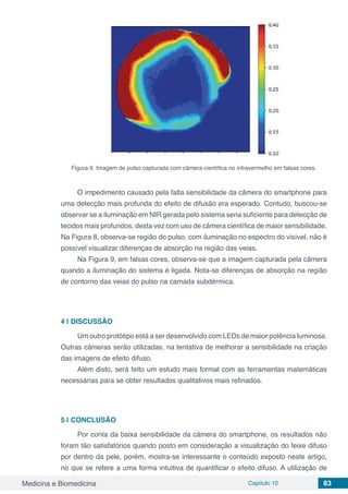 Medicina e Biomedicina Capítulo 10 83
Figura 9. Imagem de pulso capturada com câmera científica no infravermelho em falsas cores.
O impedimento causado pela falta sensibilidade da câmera do smartphone para
uma detecção mais profunda do efeito de difusão era esperado. Contudo, buscou-se
observar se a iluminação em NIR gerada pelo sistema seria suficiente para detecção de
tecidos mais profundos, desta vez com uso de câmera científica de maior sensibilidade.
Na Figura 8, observa-se região do pulso, com iluminação no espectro do visível, não é
possível visualizar diferenças de absorção na região das veias.
Na Figura 9, em falsas cores, observa-se que a imagem capturada pela câmera
quando a iluminação do sistema é ligada. Nota-se diferenças de absorção na região
de contorno das veias do pulso na camada subdérmica.
4 | DISCUSSÃO
Um outro protótipo está a ser desenvolvido com LEDs de maior potência luminosa.
Outras câmeras serão utilizadas, na tentativa de melhorar a sensibilidade na criação
das imagens de efeito difuso.
Além disto, será feito um estudo mais formal com as ferramentas matemáticas
necessárias para se obter resultados qualitativos mais refinados.
5 | CONCLUSÃO
Por conta da baixa sensibilidade da câmera do smartphone, os resultados não
foram tão satisfatórios quando posto em consideração a visualização do feixe difuso
por dentro da pele, porém, mostra-se interessante o conteúdo exposto neste artigo,
no que se refere a uma forma intuitiva de quantificar o efeito difuso. A utilização de
 