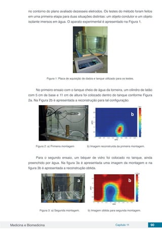 Medicina e Biomedicina Capítulo 11 90
no contorno do plano avaliado dezesseis eletrodos. Os testes do método foram feitos
em uma primeira etapa para duas situações distintas: um objeto condutor e um objeto
isolante imersos em água. O aparato experimental é apresentado na Figura 1.
Figura 1: Placa de aquisição de dados e tanque utilizado para os testes.
No primeiro ensaio com o tanque cheio de água da torneira, um cilindro de latão
com 5 cm de base e 11 cm de altura foi colocado dentro do tanque conforme Figura
2a. Na Figura 2b é apresentada a reconstrução para tal configuração.
Figura 2: a) Primeira montagem b) Imagem reconstruída da primeira montagem.
Para o segundo ensaio, um béquer de vidro foi colocado no tanque, ainda
preenchido por água. Na figura 3a é apresentada uma imagem da montagem e na
figura 3b é apresentada a reconstrução obtida.
Figura 3: a) Segunda montagem. b) Imagem obtida para segunda montagem.
 