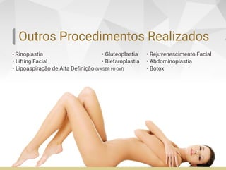 Outros Procedimentos Realizados
• Rinoplastia
• Lifting Facial
• Lipoaspiração de Alta Deﬁnição (VASER HI-Def)
• Gluteoplastia
• Blefaroplastia
• Rejuvenescimento Facial
• Abdominoplastia
• Botox
 