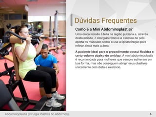 6
Como é a Mini Abdominoplastia?
Uma única incisão é feita na região pubiana e, através
desta incisão, o cirurgião remove o excesso de pele,
aperta os músculos soltos e usa a lipoaspiração para
reﬁnar ainda mais a área.
A paciente ideal para o procedimento possui ﬂacidez e
certo volume abaixo do umbigo. A mini abdominoplastia
é recomendada para mulheres que sempre estiveram em
boa forma, mas não conseguem atingir seus objetivos
unicamente com dieta e exercício.
Dúvidas Frequentes
Abdominoplastia (Cirurgia Plástica no Abdômen)
 