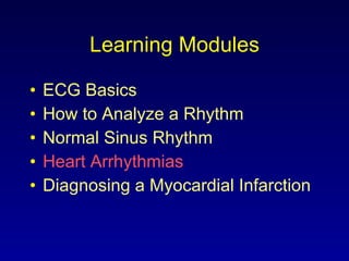 Learning Modules ECG Basics How to Analyze a Rhythm Normal Sinus Rhythm Heart Arrhythmias Diagnosing a Myocardial Infarction 