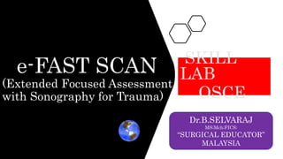 e-FAST SCAN
(Extended Focused Assessment
with Sonography for Trauma)
SKILL
LAB
OSCE
Dr.B.SELVARAJ
MS;Mch;FICS;
“SURGICAL EDUCATOR”
MALAYSIA
 