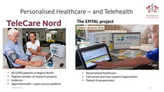 02-01-2017 30
Personalised Healthcare – and Telehealth
• All COPD patients in Region North
• Highest number of research projects
• Evidence
• OpenTelehealth – open source platform
The EPITAL project
• Personalised Healthcare
• Call center and new support organisation
• Patient Empowerment
 