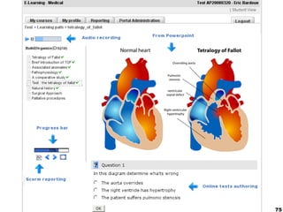 75
SCORM
Sharable Content Object Reference Model (SCORM)
collection of standards and specifications for web-based e-learning
Origin: US Department of Defense
packaged into a transferable ZIP file
SCORM 2004: Sequencing
set of rules that specifies the
order in which a learner may experience content objects.
 